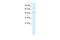 Tripartite Motif Containing 69 antibody, 28-186, ProSci, Western Blot image 