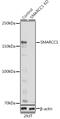 SWI/SNF Related, Matrix Associated, Actin Dependent Regulator Of Chromatin Subfamily C Member 1 antibody, GTX55802, GeneTex, Western Blot image 