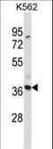 C-Type Lectin Domain Containing 7A antibody, LS-C168838, Lifespan Biosciences, Western Blot image 