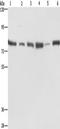 Sirtuin 1 antibody, TA349438, Origene, Western Blot image 