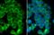 Desmoglein 2 antibody, GTX102508, GeneTex, Immunocytochemistry image 