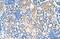 Solute Carrier Family 38 Member 1 antibody, NBP1-59650, Novus Biologicals, Immunohistochemistry paraffin image 