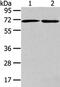 ADP Ribosylation Factor GTPase Activating Protein 2 antibody, CSB-PA137594, Cusabio, Western Blot image 