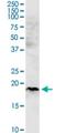 Coiled-Coil-Helix-Coiled-Coil-Helix Domain Containing 4 antibody, H00131474-M01-100ug, Novus Biologicals, Western Blot image 