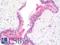 Peroxisome Proliferator Activated Receptor Alpha antibody, LS-C163888, Lifespan Biosciences, Immunohistochemistry paraffin image 