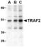 TRAP antibody, TA306276, Origene, Western Blot image 