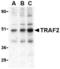 TNF Receptor Associated Factor 2 antibody, TA306276, Origene, Western Blot image 