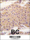 Transforming Growth Factor Beta 2 antibody, 57-975, ProSci, Immunohistochemistry paraffin image 