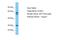 ALS2 C-Terminal Like antibody, A11203, Boster Biological Technology, Western Blot image 