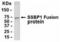 Single Stranded DNA Binding Protein 1 antibody, XW-8089, ProSci, Western Blot image 