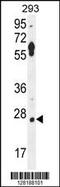 Leucine Rich Repeat Containing 57 antibody, MBS9205806, MyBioSource, Western Blot image 