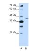 Zinc Finger Protein 488 antibody, NBP1-80421, Novus Biologicals, Western Blot image 