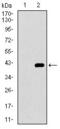 Integrin Subunit Alpha 2b antibody, GTX60763, GeneTex, Western Blot image 
