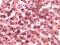 Casein Kinase 1 Alpha 1 antibody, 32-137, ProSci, Immunohistochemistry paraffin image 