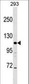 Adaptor Related Protein Complex 3 Subunit Beta 2 antibody, LS-C156390, Lifespan Biosciences, Western Blot image 