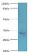 Caspase 6 antibody, MBS1497359, MyBioSource, Western Blot image 