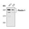 Plectin antibody, PA5-17156, Invitrogen Antibodies, Western Blot image 