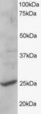 101F6 antibody, GTX89745, GeneTex, Western Blot image 