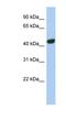 Trans-Golgi Network Protein 2 antibody, NBP1-62556, Novus Biologicals, Western Blot image 