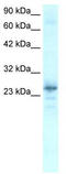 Homeobox protein Nkx-2.8 antibody, TA329423, Origene, Western Blot image 