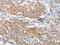Cysteine Rich With EGF Like Domains 2 antibody, CSB-PA919659, Cusabio, Immunohistochemistry paraffin image 
