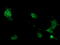 Phosphorylase Kinase Catalytic Subunit Gamma 2 antibody, M07871-1, Boster Biological Technology, Immunofluorescence image 