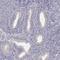 GLIPR1 Like 2 antibody, PA5-58956, Invitrogen Antibodies, Immunohistochemistry frozen image 