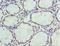 Thrombospondin 3 antibody, LS-C376775, Lifespan Biosciences, Immunohistochemistry paraffin image 