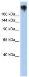 Polycystin Family Receptor For Egg Jelly antibody, TA338560, Origene, Western Blot image 