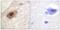 DEAD-Box Helicase 3 X-Linked antibody, PA5-38470, Invitrogen Antibodies, Immunohistochemistry paraffin image 