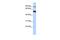 DExD-Box Helicase 50 antibody, GTX47499, GeneTex, Western Blot image 