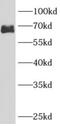 Rho GTPase Activating Protein 9 antibody, FNab00554, FineTest, Western Blot image 