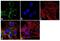 Neurofibromin 1 antibody, GTX15776, GeneTex, Immunocytochemistry image 
