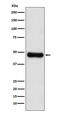 Adenosine Kinase antibody, M02193-2, Boster Biological Technology, Western Blot image 