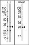 Protein Kinase AMP-Activated Non-Catalytic Subunit Beta 1 antibody, AP13597PU-N, Origene, Western Blot image 