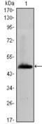 Hyaluronan Synthase 1 antibody, STJ98126, St John