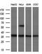 Uridine-Cytidine Kinase 1 antibody, MA5-25204, Invitrogen Antibodies, Western Blot image 