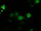 Cytochrome P450 Oxidoreductase antibody, LS-C784396, Lifespan Biosciences, Immunofluorescence image 