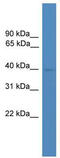 Zona Pellucida Binding Protein 2 antibody, TA337616, Origene, Western Blot image 