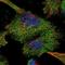 Homer Scaffold Protein 2 antibody, NBP1-85487, Novus Biologicals, Immunocytochemistry image 