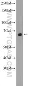 Acyl-CoA Synthetase Medium Chain Family Member 5 antibody, 16591-1-AP, Proteintech Group, Western Blot image 