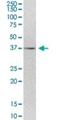 TMEM231 antibody, H00079583-B01P, Novus Biologicals, Western Blot image 