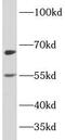 Zinc finger protein PLAGL2 antibody, FNab06517, FineTest, Western Blot image 