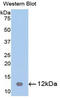 Cystatin B antibody, LS-C293621, Lifespan Biosciences, Western Blot image 