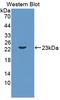 Interleukin 11 antibody, LS-C372420, Lifespan Biosciences, Western Blot image 