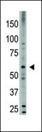 Bone Morphogenetic Protein 6 antibody, LS-C97868, Lifespan Biosciences, Western Blot image 