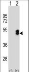 LIM Homeobox Transcription Factor 1 Beta antibody, LS-C165816, Lifespan Biosciences, Western Blot image 