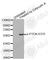 Phosphatase And Tensin Homolog antibody, AP0435, ABclonal Technology, Western Blot image 