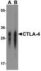 Cytotoxic T-Lymphocyte Associated Protein 4 antibody, TA355056, Origene, Western Blot image 