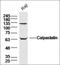 Calpastatin antibody, orb100367, Biorbyt, Western Blot image 